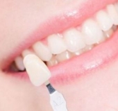 NHỮNG ĐIỀU CẦN BIẾT KHI BỌC RĂNG SỨ THẨM MỸ