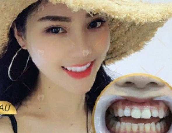 Lặng Võ Tú My