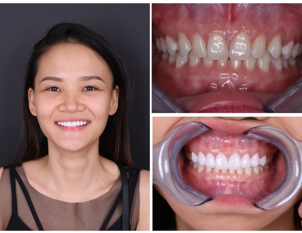 Chị Nguyễn Tiểu Phụng Gò Vấp