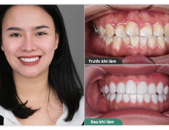 Lưu Yến Phi